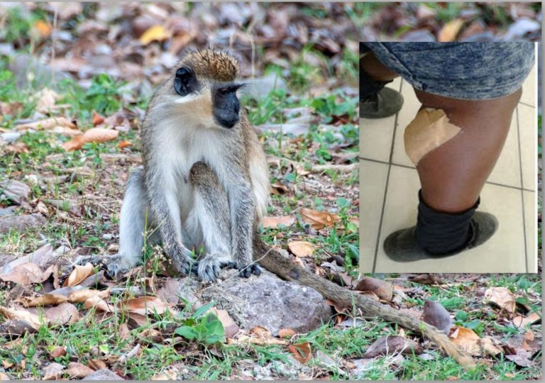 Woman In Monkey Attack Claimed Cops Laughed