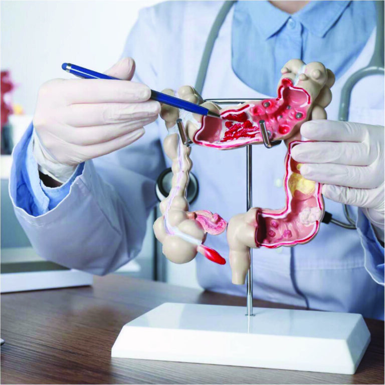More Young Adults Being Diagnosed With Gastrointestinal Cancers: Warning Signs And Advances In Treatment