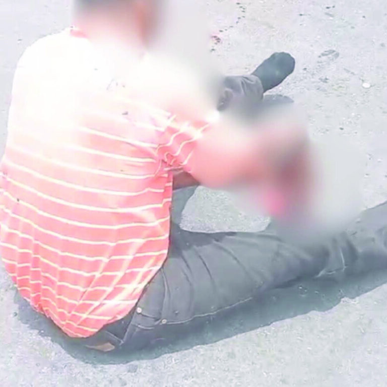 Overtaking Incident Leads to Graphic Bus Crash Injury